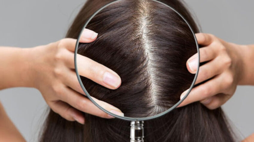Prevent Hair Fall Naturally